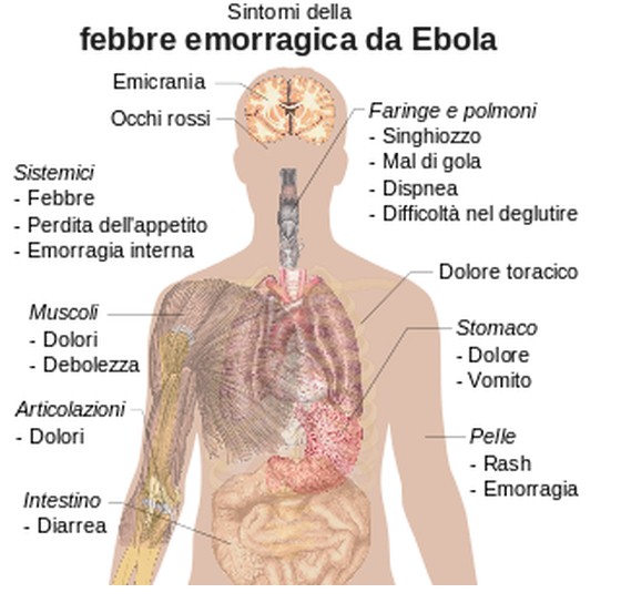 ebola sintomi